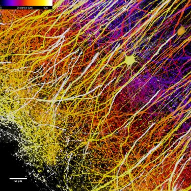 Mouse-Brain_thy1-GFP_600x600x1000um_MaxProj_KCL-IoPPN Mouse-Brain_thy1-GFP_600x600x1000um_MaxProj_KCL-IoPPN